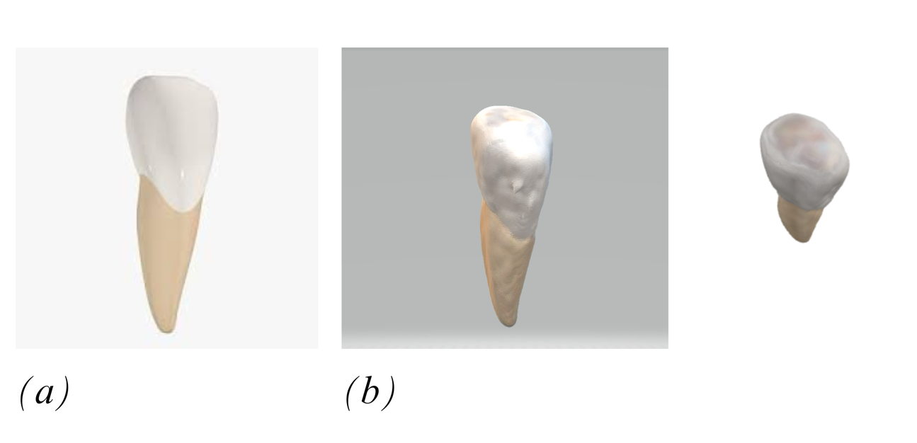 A close-up of a tooth

Description automatically generated